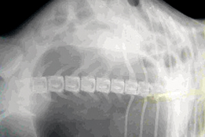 Рентген брюшной полости
